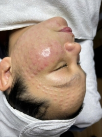 Meso trắng da