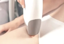 Triệt bikini