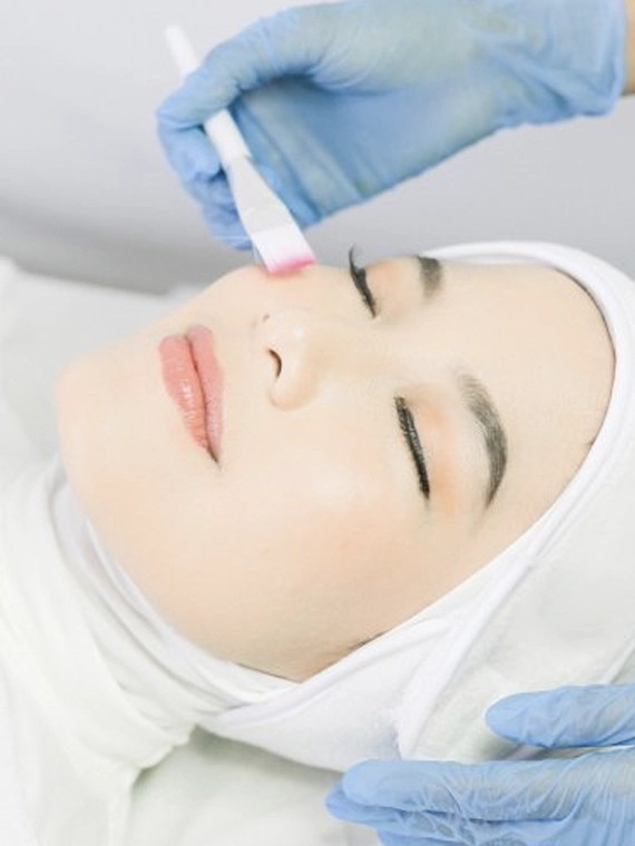 ACNE PEELING 17% SALICYLIC