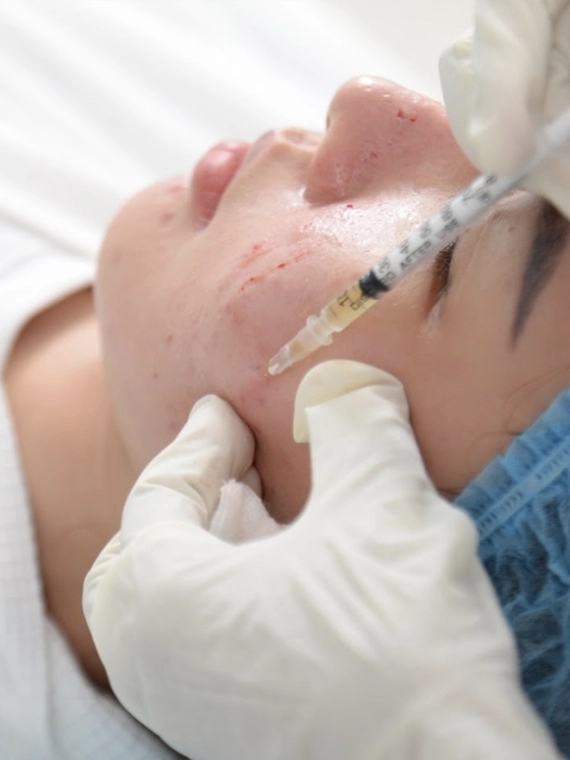 PRP - Phục hồi