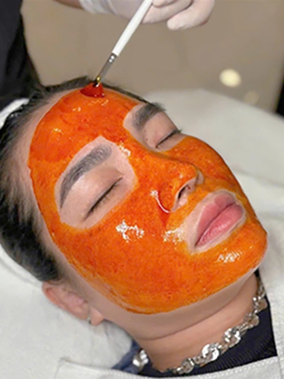Điều trị mụn